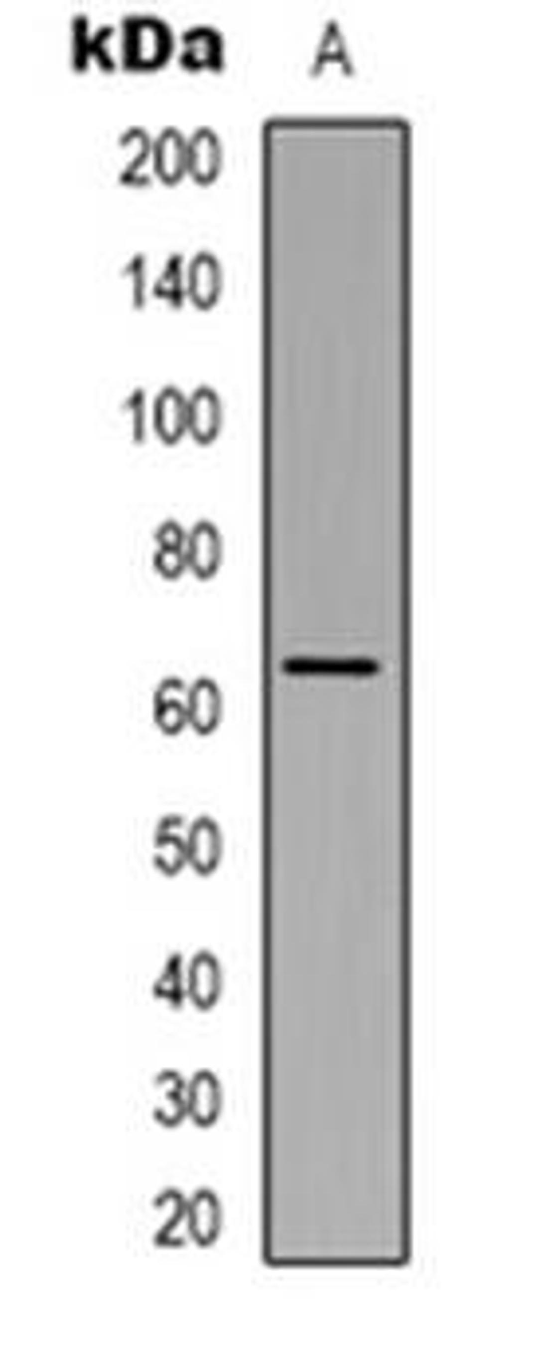 Western blot analysis of NHE8 expression in HepG2 (Lane 1) whole cell lysates using SLC9A8 antibody