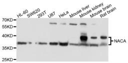 Western blot analysis of extracts of various cells using NACA antibody