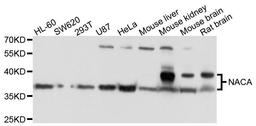 Western blot analysis of extracts of various cells using NACA antibody