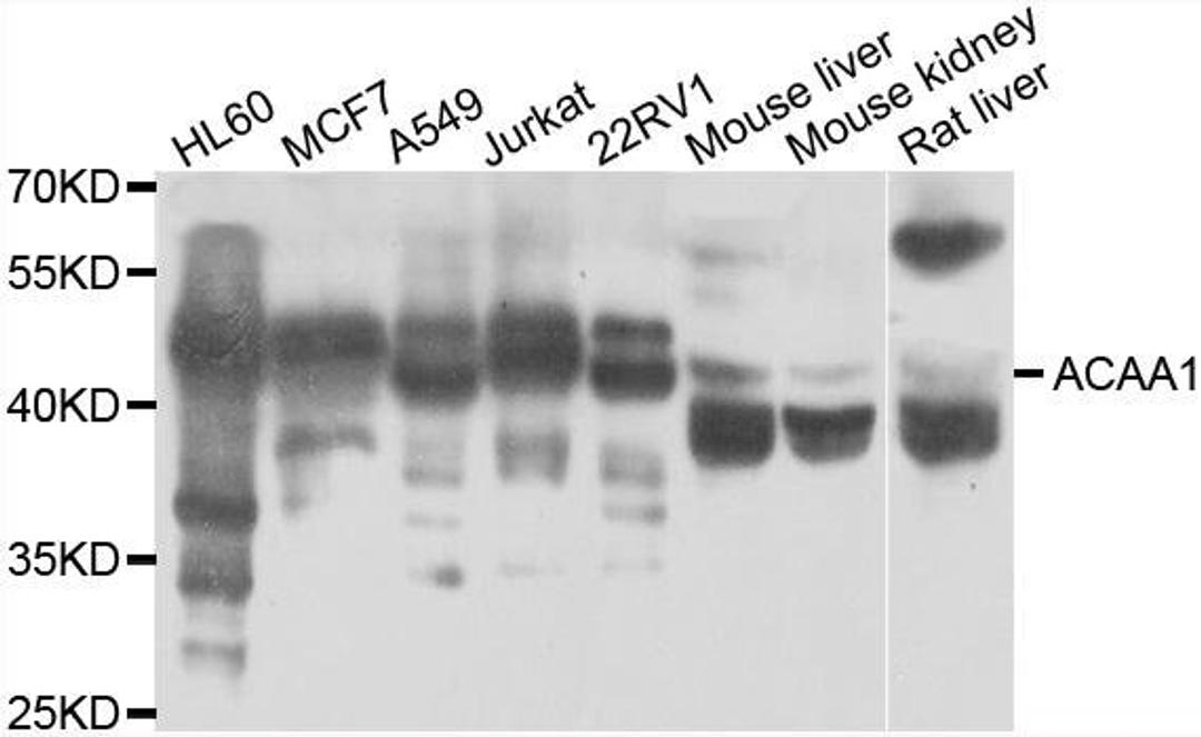 Western blot analysis of extracts of various cell lines using ACAA1 antibody