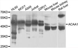 Western blot analysis of extracts of various cell lines using ACAA1 antibody