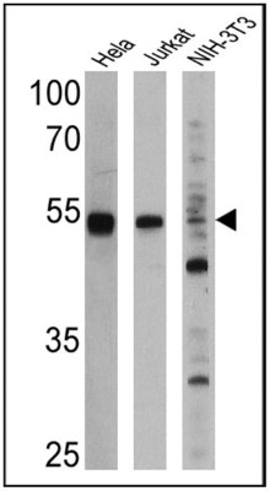 Western Blot: PPAR alpha/NR1C1 Antibody (3B6/PPAR) [NB300-537] - Analysis of 25 ug of Hela (Lane 1), Jurkat (Lane 2), and NIH-3T3 cell lysates (Lane 3) and a molecular weight protein ladder.