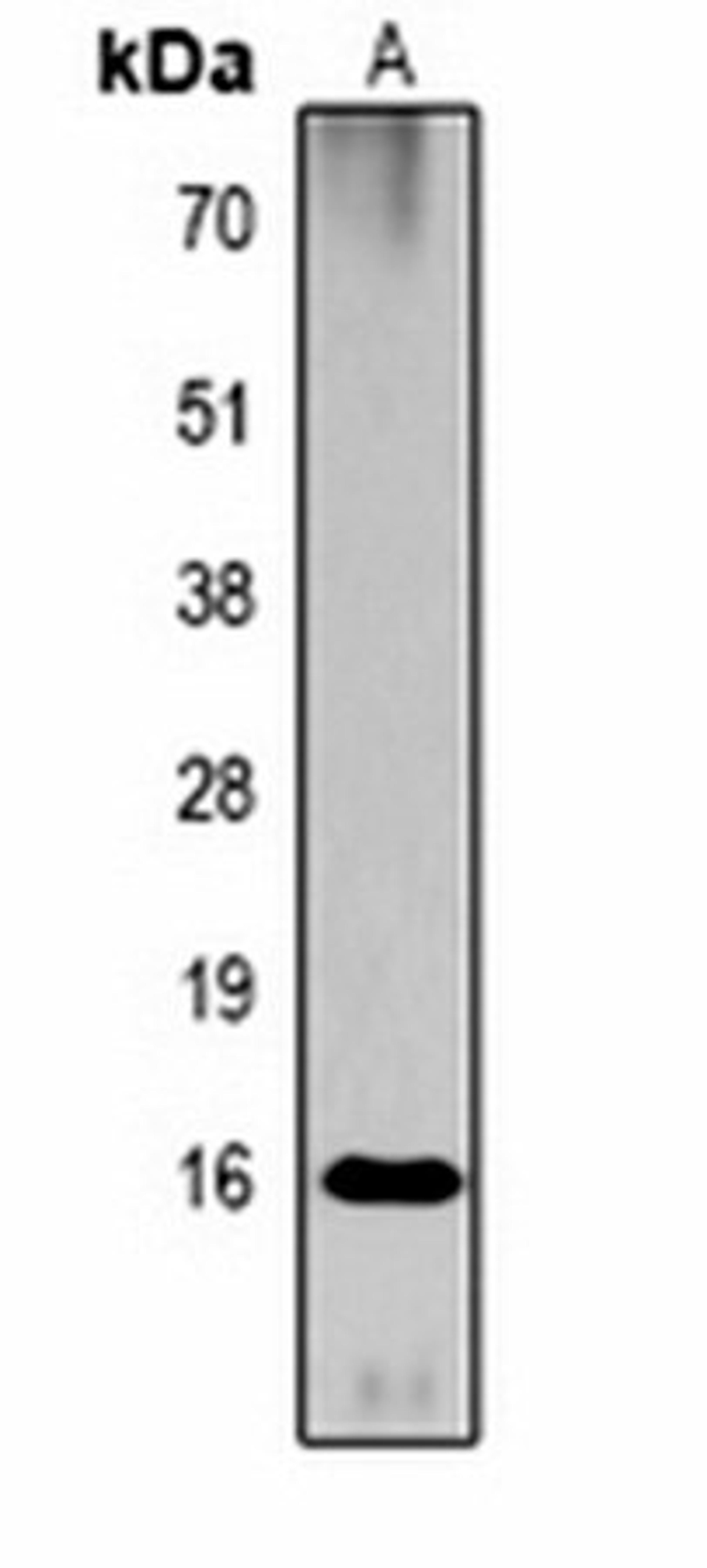 Western blot analysis of  Hela TSA-treated (Lane1) whole cell lysates using Histone H3 (AcK79) antibody