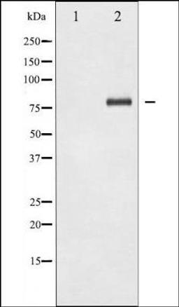 Western blot analysis of HeLa cells using NFkB p65 -Lys310- antibody