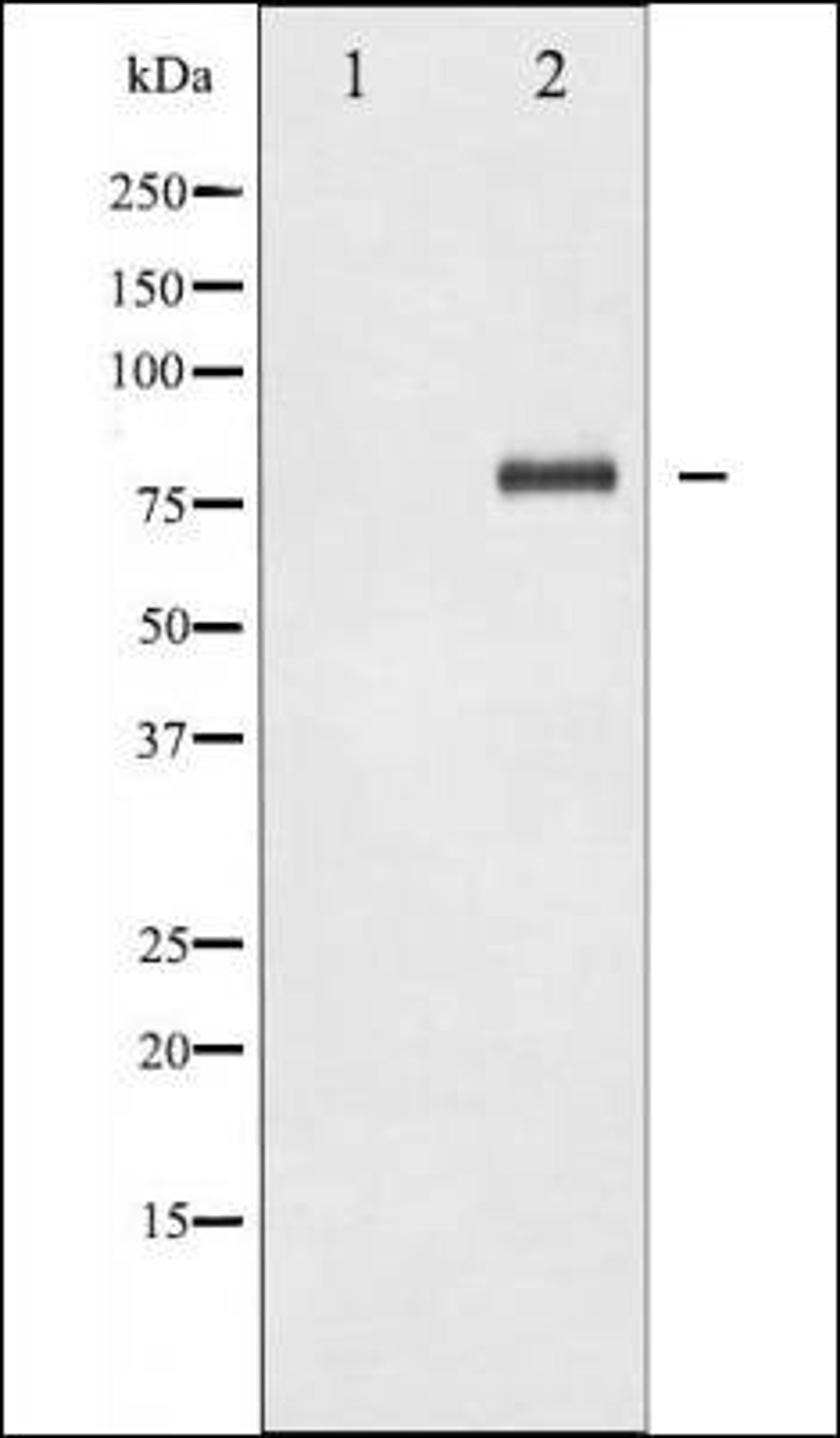 Western blot analysis of HeLa cells using NFkB p65 -Lys310- antibody