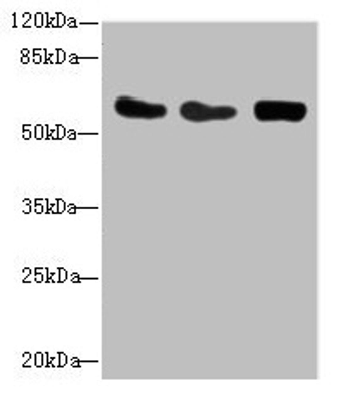 Western blot. All lanes: CSRNP2 antibody at 2.71µg/ml. Lane 1: Mouse heart tissue. Lane 2: HepG2 whole cell lysate. Lane 3: Mouse brain tissue. Secondary. Goat polyclonal to rabbit IgG at 1/10000 dilution. Predicted band size: 60 kDa. Observed band size: 60 kDa