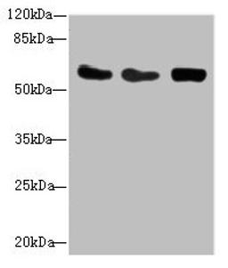 Western blot. All lanes: CSRNP2 antibody at 2.71µg/ml. Lane 1: Mouse heart tissue. Lane 2: HepG2 whole cell lysate. Lane 3: Mouse brain tissue. Secondary. Goat polyclonal to rabbit IgG at 1/10000 dilution. Predicted band size: 60 kDa. Observed band size: 60 kDa