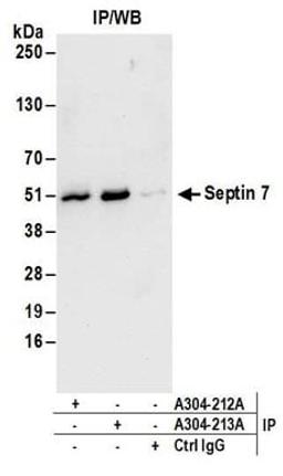 Detection of human Septin 7 by western blot of immunoprecipitates.