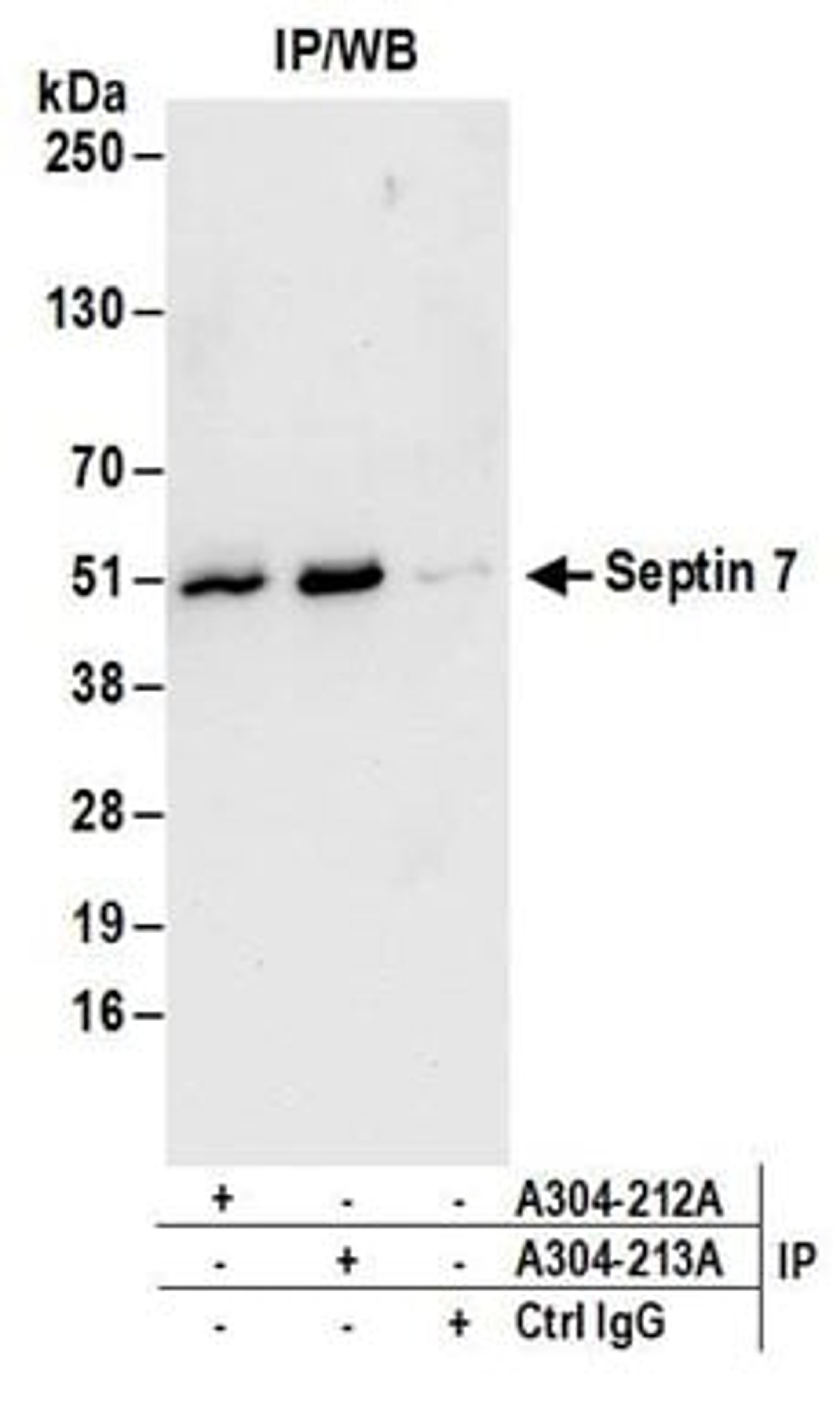 Detection of human Septin 7 by western blot of immunoprecipitates.