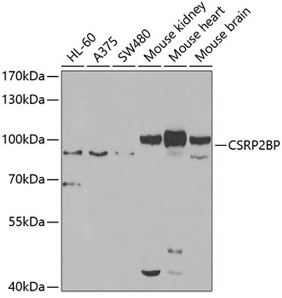 Western blot - CSRP2BP antibody (A7380)