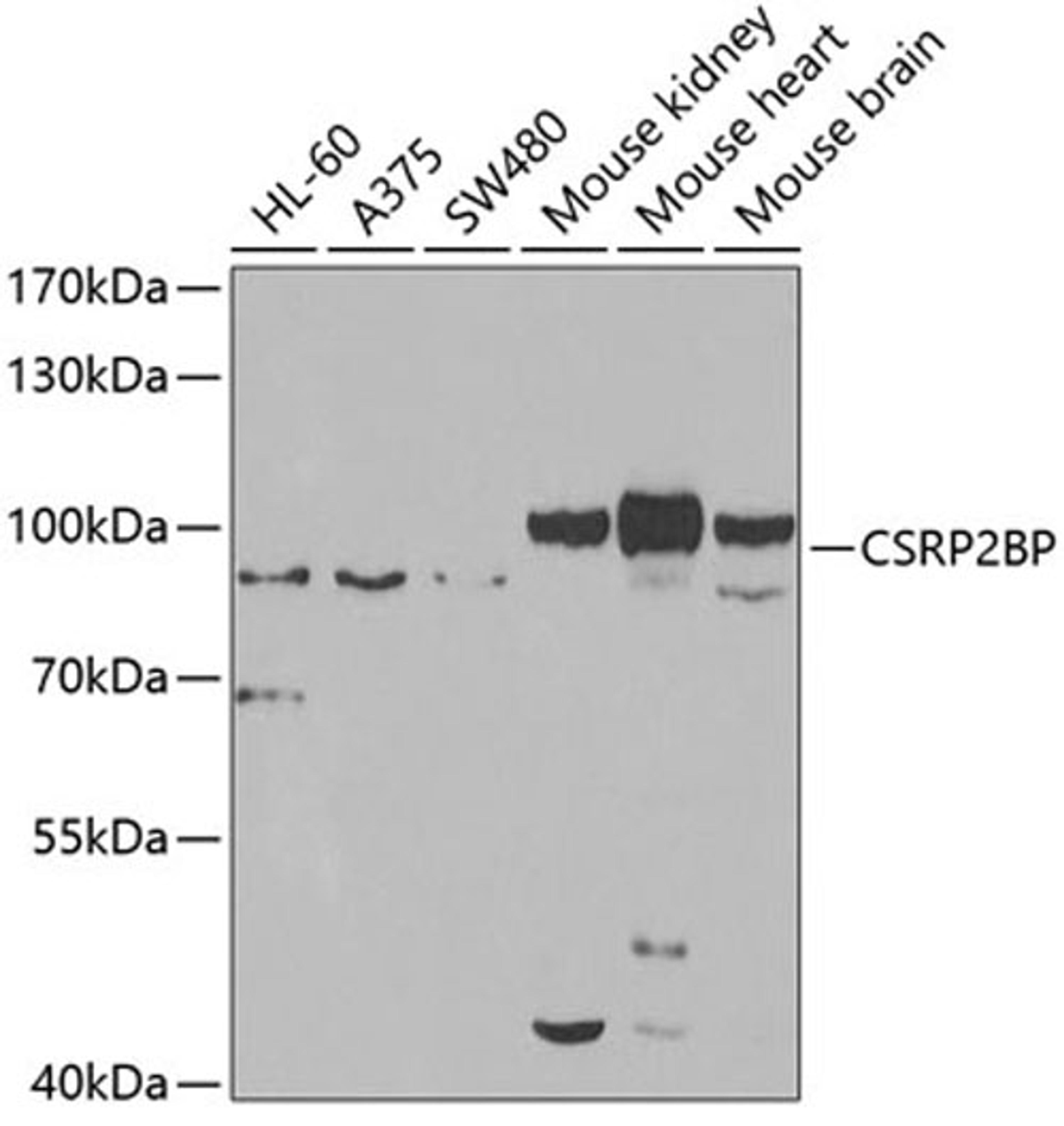 Western blot - CSRP2BP antibody (A7380)