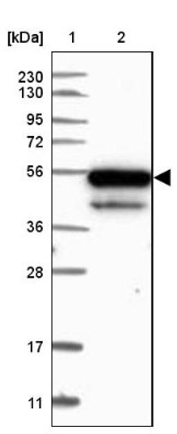 Western Blot: KBTBD4 Antibody [NBP1-88587] - Lane 1: Marker [kDa] 230, 130, 95, 72, 56, 36, 28, 17, 11<br/>Lane 2: Human cell line RT-4