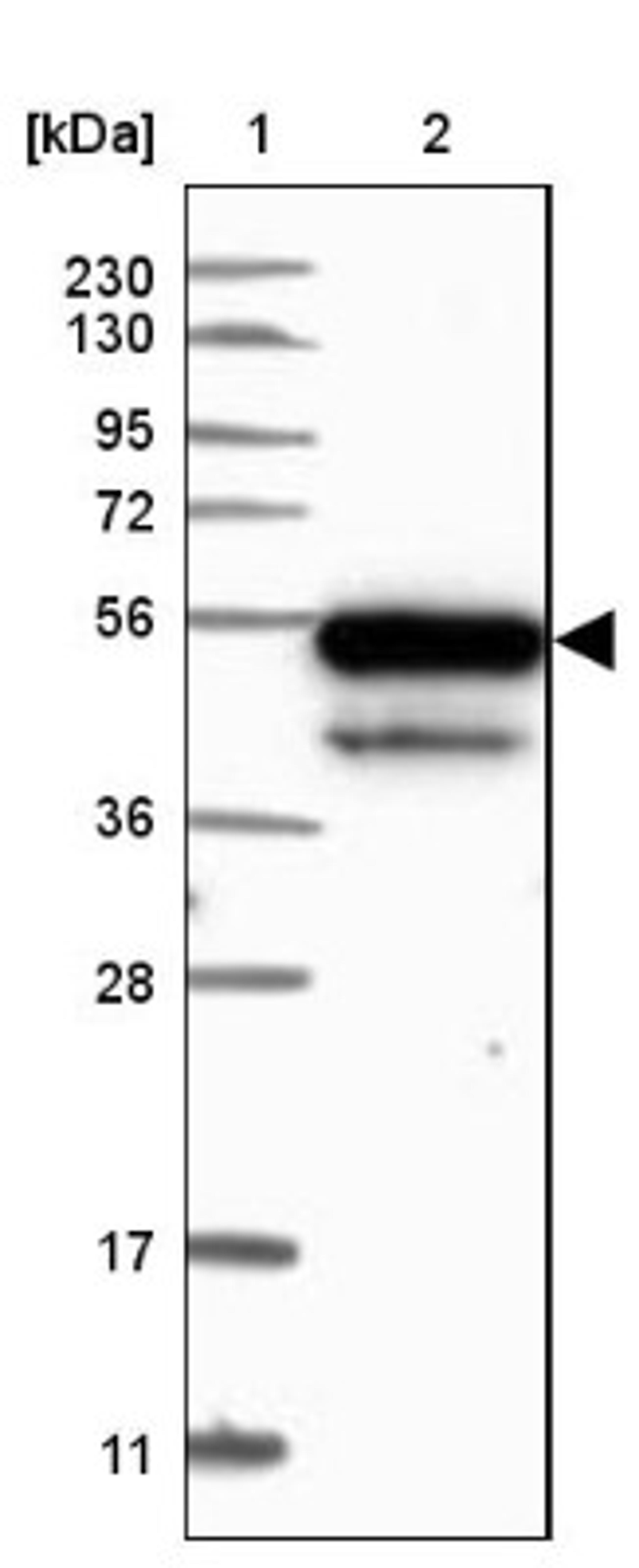 Western Blot: KBTBD4 Antibody [NBP1-88587] - Lane 1: Marker [kDa] 230, 130, 95, 72, 56, 36, 28, 17, 11<br/>Lane 2: Human cell line RT-4