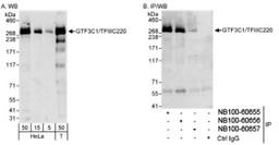 Western Blot: TFIIIC Antibody [NB100-60657] - Detection of Human GTF3C1/TFIIIC220 on HeLa whole cell lysate using NB100-60657. GTF3C1/TFIIIC220 was efficiently IPed by rabbit anti-GTF3C1/TFIIIC220 antibodies NB100-60655 and NB100-60656.