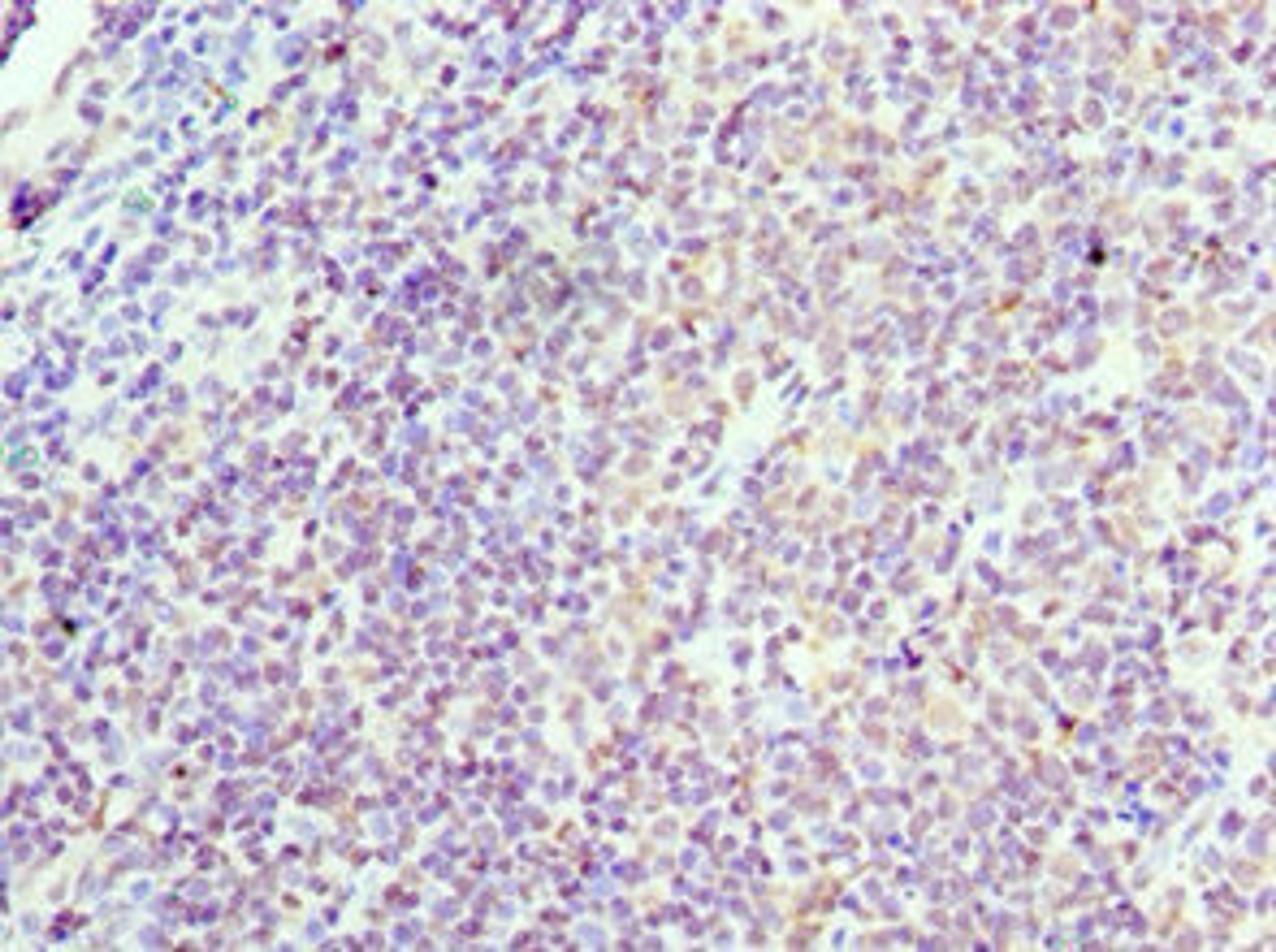 Immunohistochemistry of paraffin-embedded human tonsil tissue using CSB-PA004814ESR2HU at dilution of 1:100