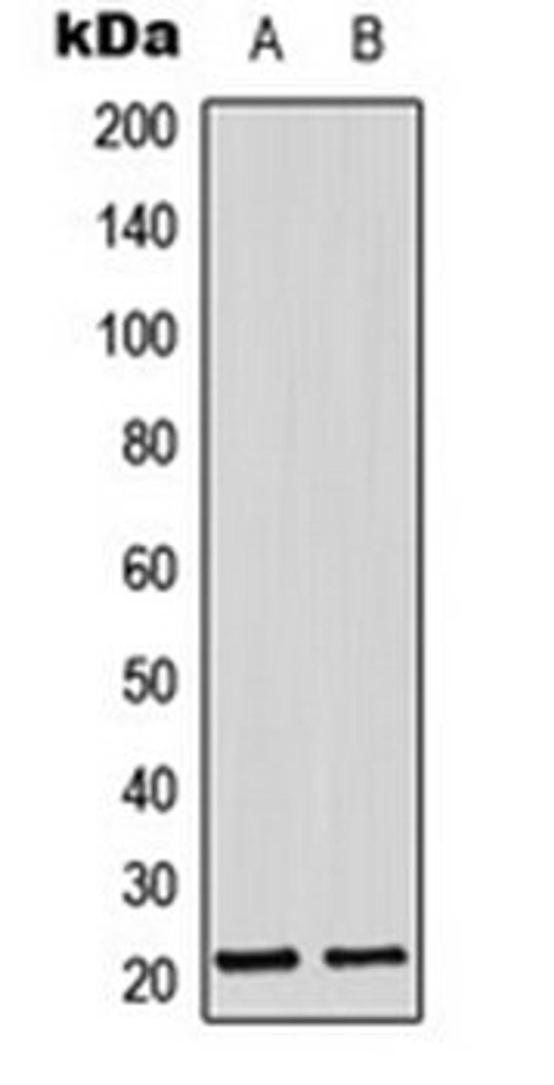 Western blot analysis of MCF7 (Lane 1), mouse lung (Lane 2) whole cell lysates using ADM antibody