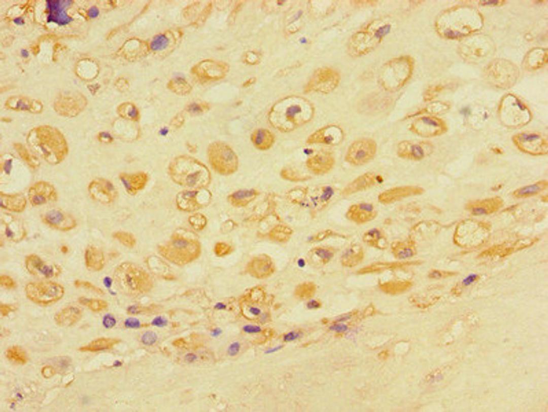 Immunohistochemistry of paraffin-embedded human placental tissue using CSB-PA878955LA01HU at dilution of 1:100
