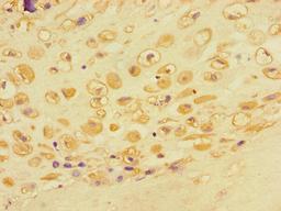 Immunohistochemistry of paraffin-embedded human placental tissue using CSB-PA878955LA01HU at dilution of 1:100