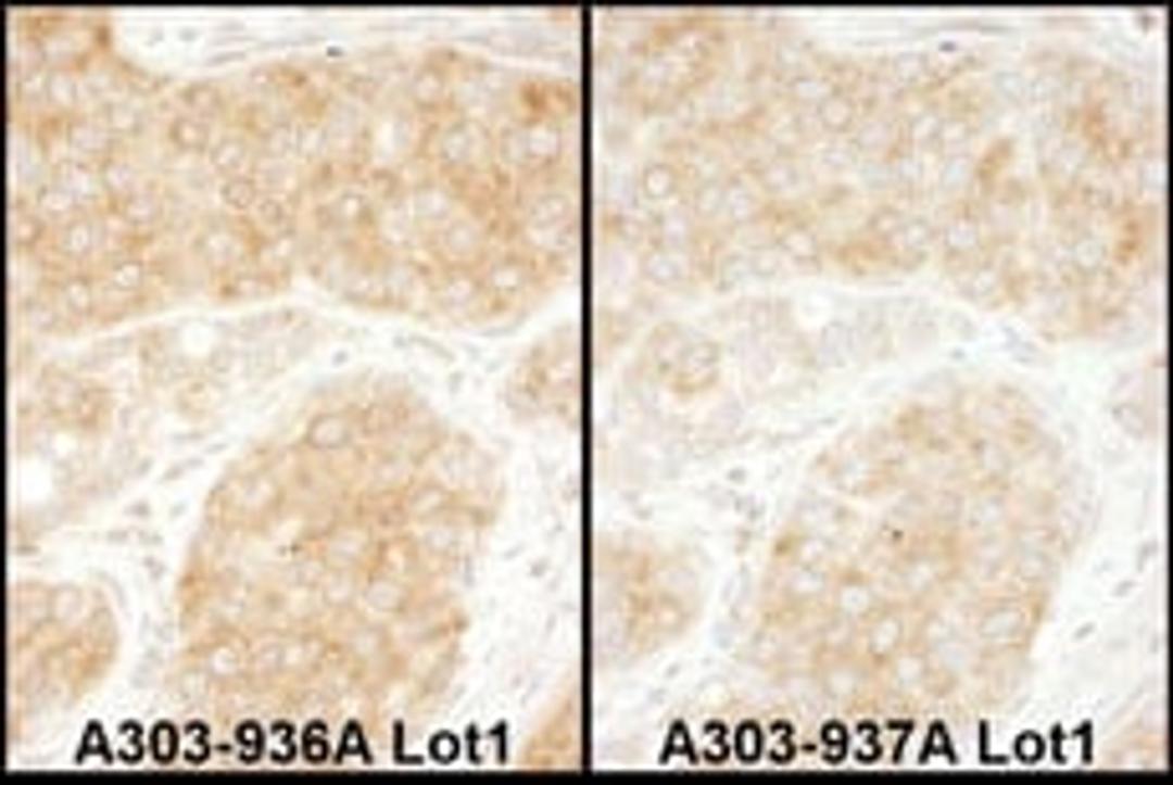 Detection of human RPS11 by immunohistochemistry.