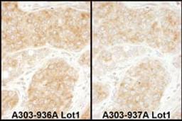 Detection of human RPS11 by immunohistochemistry.