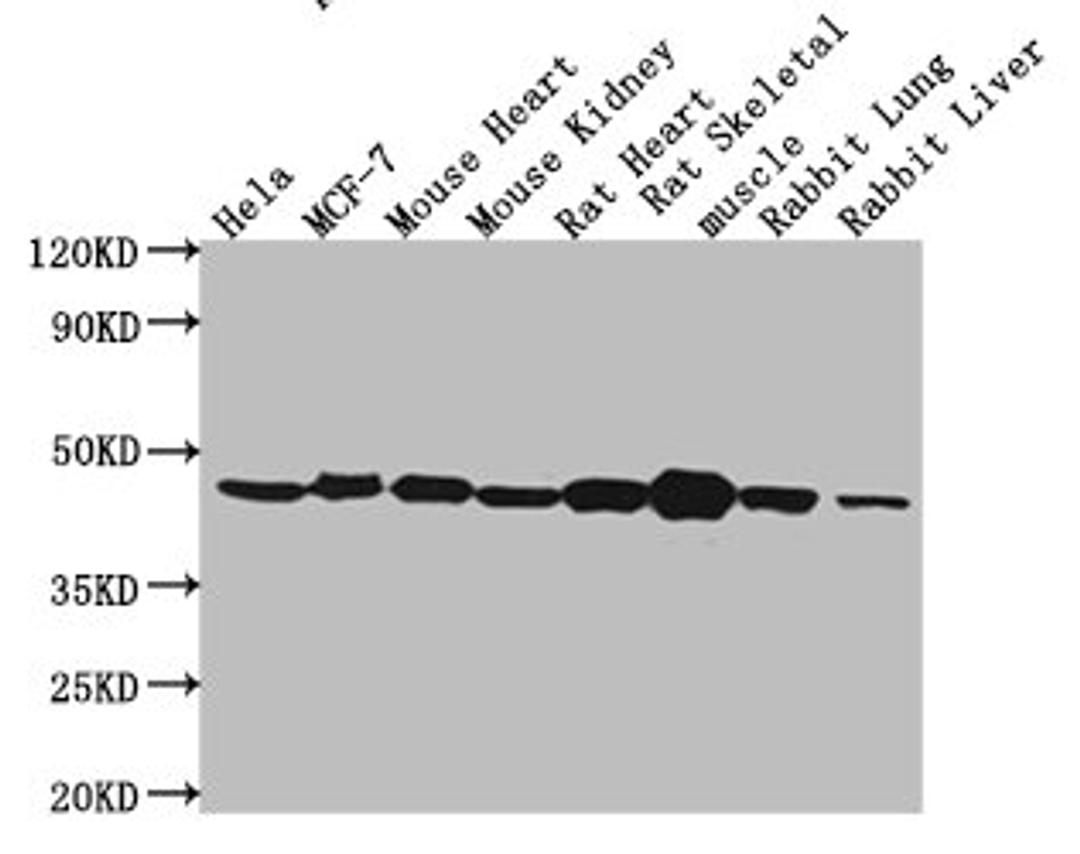 Western Blot. Positive WB detected in: Hela whole cell lysate, MCF-7 whole cell lysate, Mouse heart tissue, Mouse kidney tissue, Rat heart tissue, Rat skeletal muscle tissue, Rabbit lung tissue, Rabbit liver tissue. All lanes: ACTB antibody at 1:5000. Secondary. Goat polyclonal to mouse IgG at 1/50000 dilution. Predicted band size: 42 KDa. Observed band size: 42 KDa. Exposure time：5min