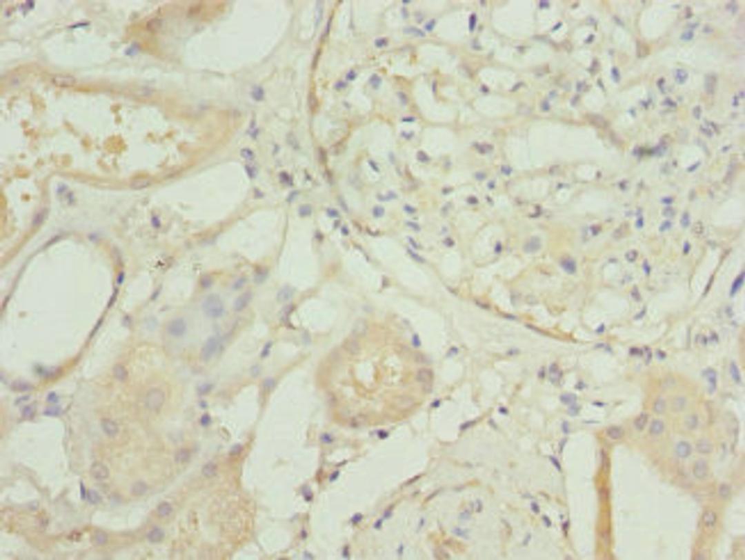 Immunohistochemistry of paraffin-embedded human kidney tissue using CSB-PA020076ESR2HU at dilution of 1:100