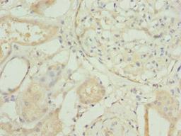 Immunohistochemistry of paraffin-embedded human kidney tissue using CSB-PA020076ESR2HU at dilution of 1:100