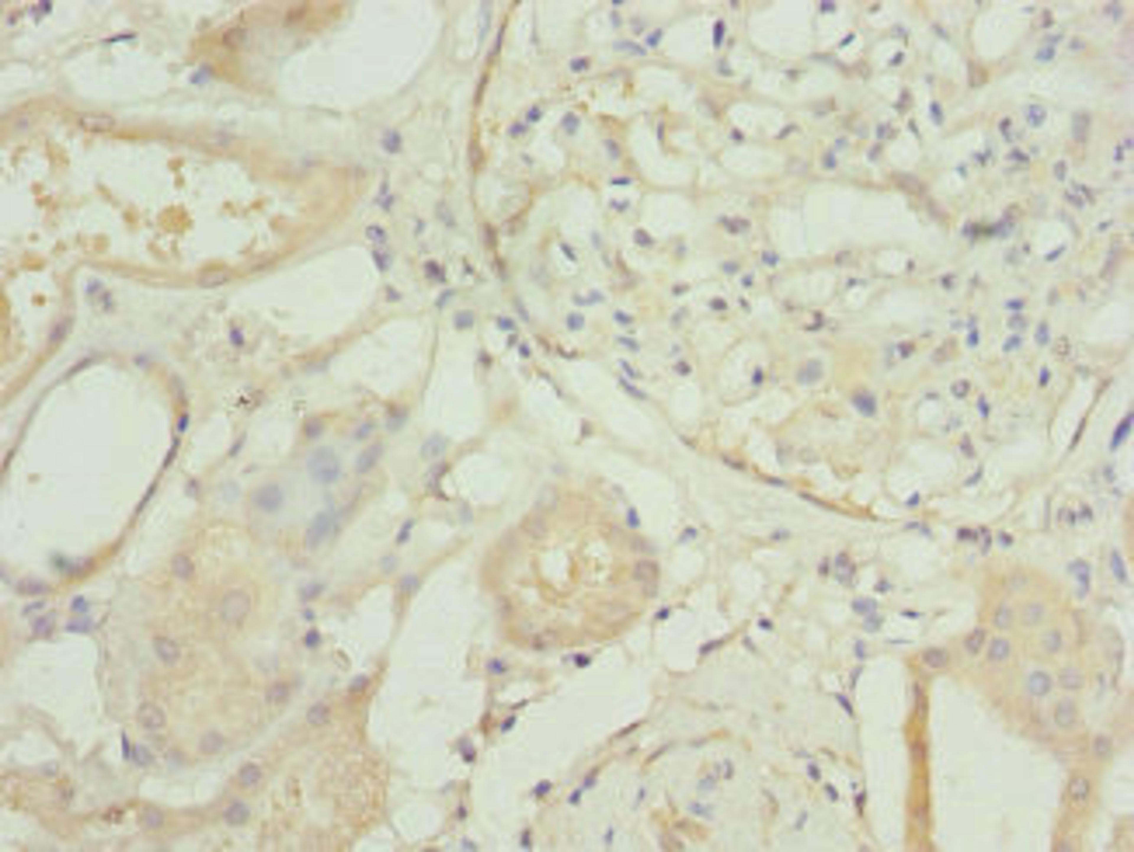 Immunohistochemistry of paraffin-embedded human kidney tissue using CSB-PA020076ESR2HU at dilution of 1:100