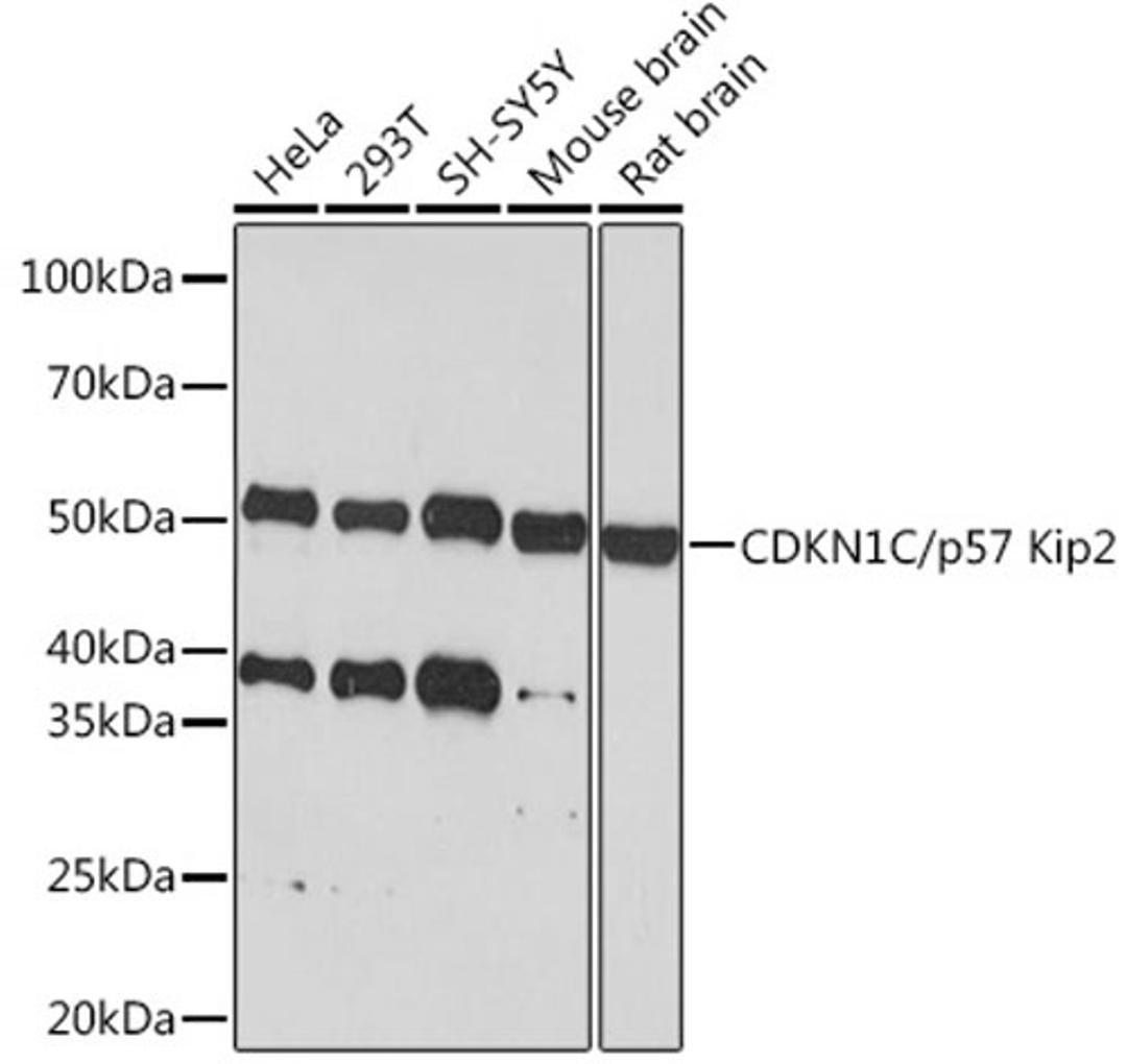 Western blot - CDKN1C/p57 Kip2  Rabbit mAb (A6843)