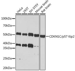 Western blot - CDKN1C/p57 Kip2  Rabbit mAb (A6843)