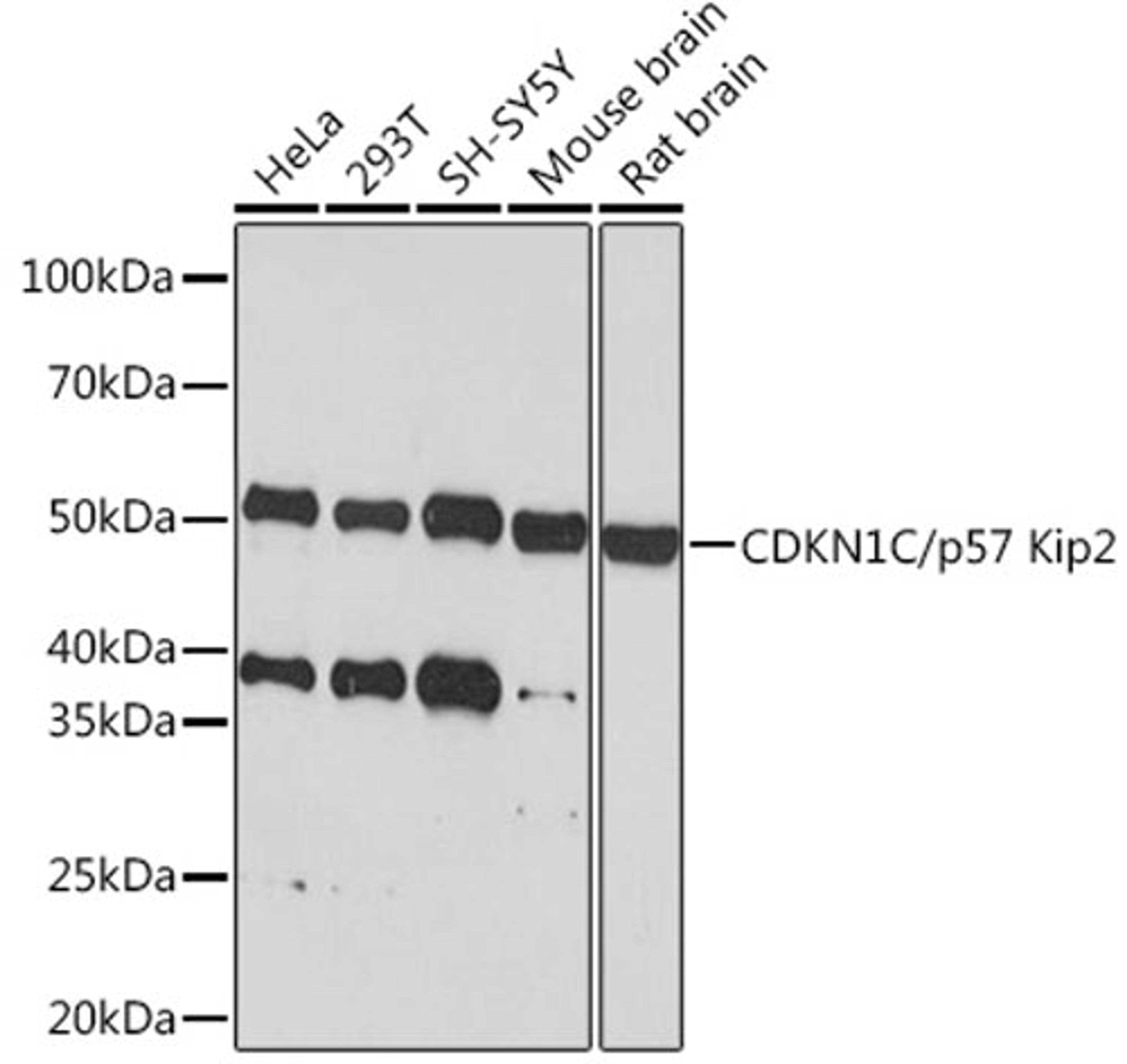 Western blot - CDKN1C/p57 Kip2  Rabbit mAb (A6843)