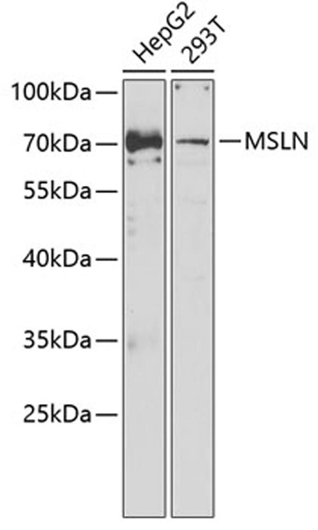 Western blot - MSLN antibody (A6183)