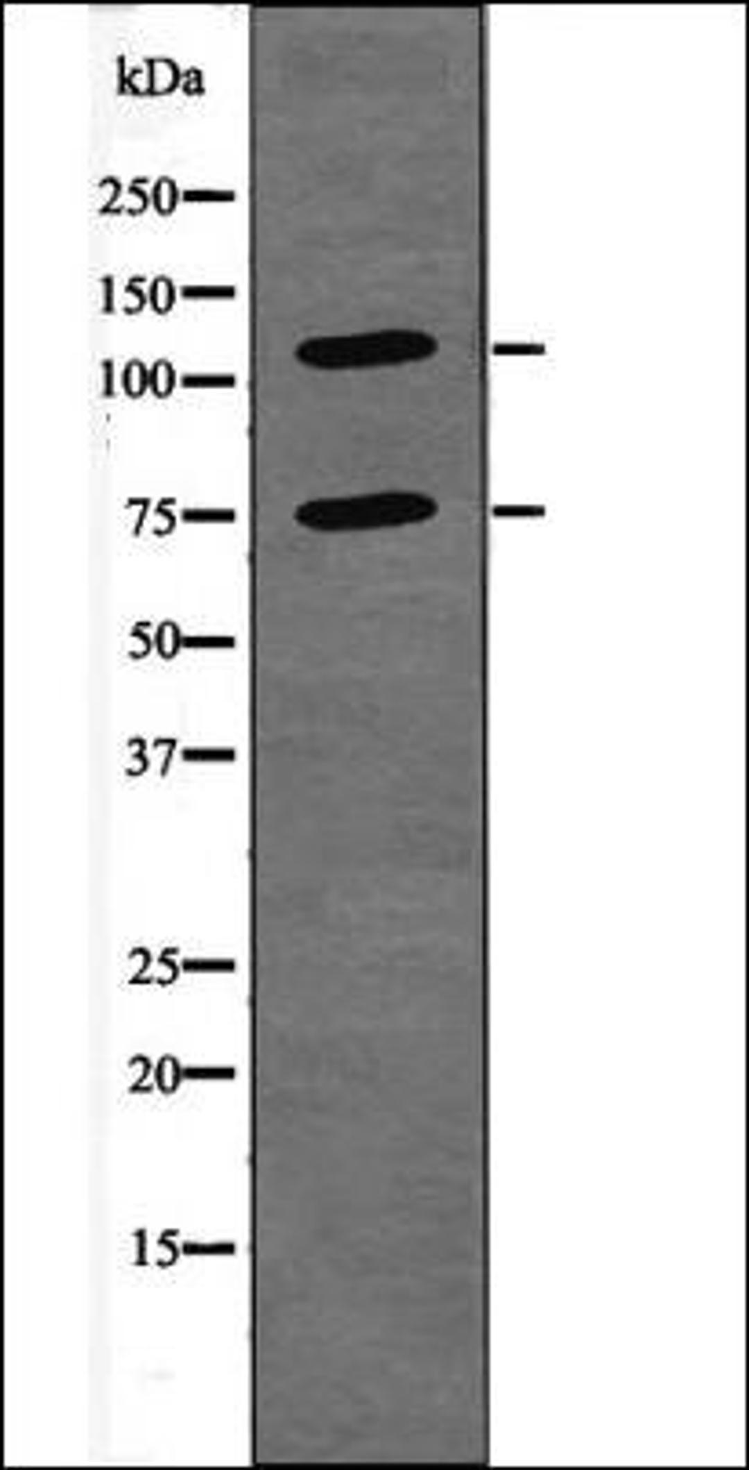 Western blot analysis of FBS treated NIH-3T3 whole cell lysates using NFAT2 -Phospho-Ser294- antibody