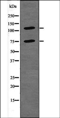 Western blot analysis of FBS treated NIH-3T3 whole cell lysates using NFAT2 -Phospho-Ser294- antibody