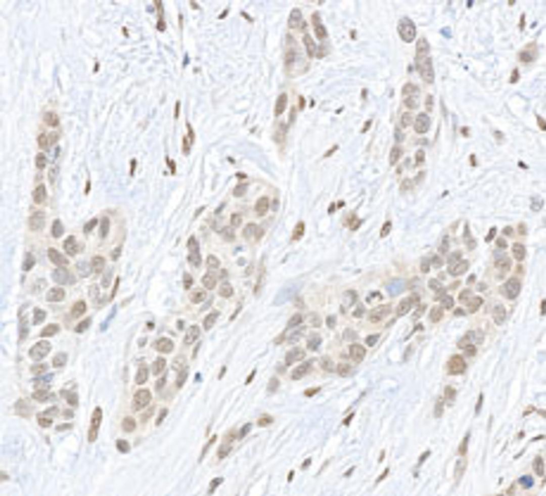 Detection of human Pc2 by immunohistochemistry.