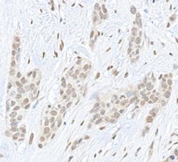 Detection of human Pc2 by immunohistochemistry.