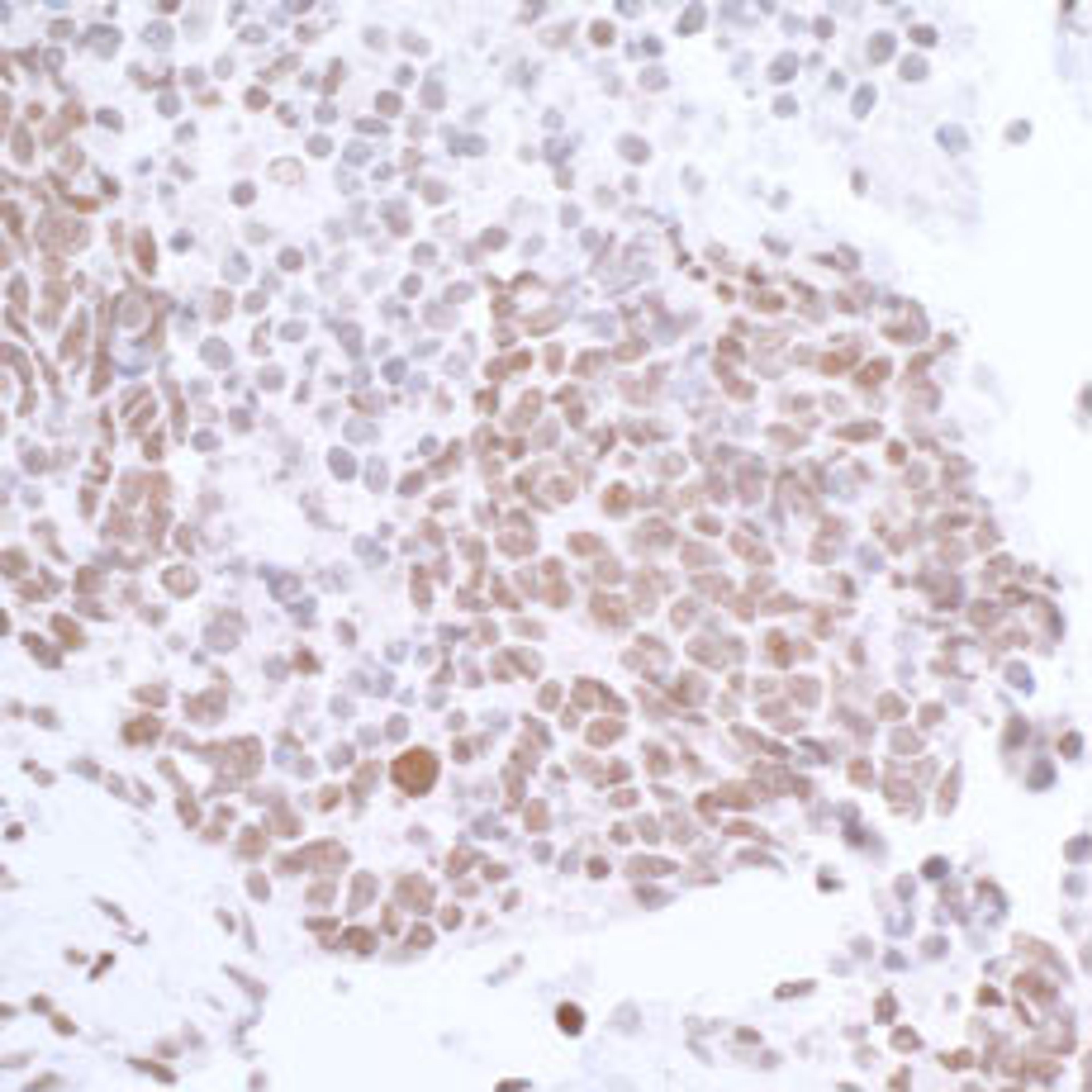 Detection of human CTCF by immunohistochemistry.