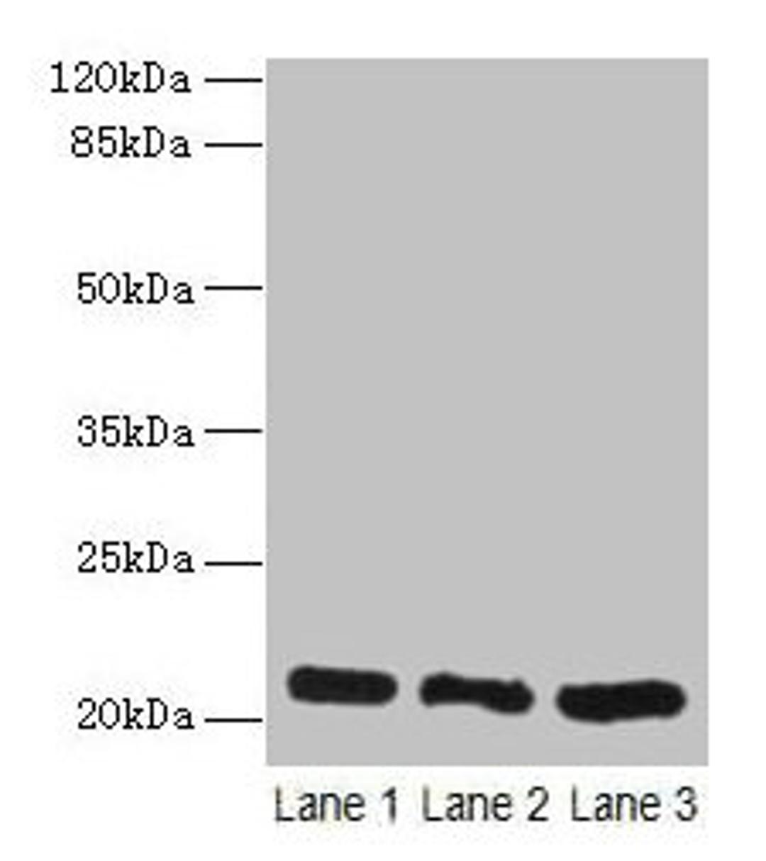 Western blot. All lanes: GM2A antibody at 10µg/ml. Lane 1: Rat liver tissue. Lane 2: Mouse stomach tissue. Lane 3: Mouse small intestine tissue. Secondary. Goat polyclonal to rabbit IgG at 1/10000 dilution. Predicted band size: 21 kDa. Observed band size: 21 kDa