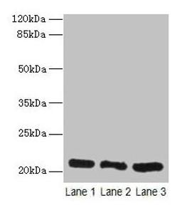 Western blot. All lanes: GM2A antibody at 10µg/ml. Lane 1: Rat liver tissue. Lane 2: Mouse stomach tissue. Lane 3: Mouse small intestine tissue. Secondary. Goat polyclonal to rabbit IgG at 1/10000 dilution. Predicted band size: 21 kDa. Observed band size: 21 kDa