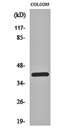 Western blot analysis of COLO205 cell lysates using PKA alpha/beta/gamma cat antibody