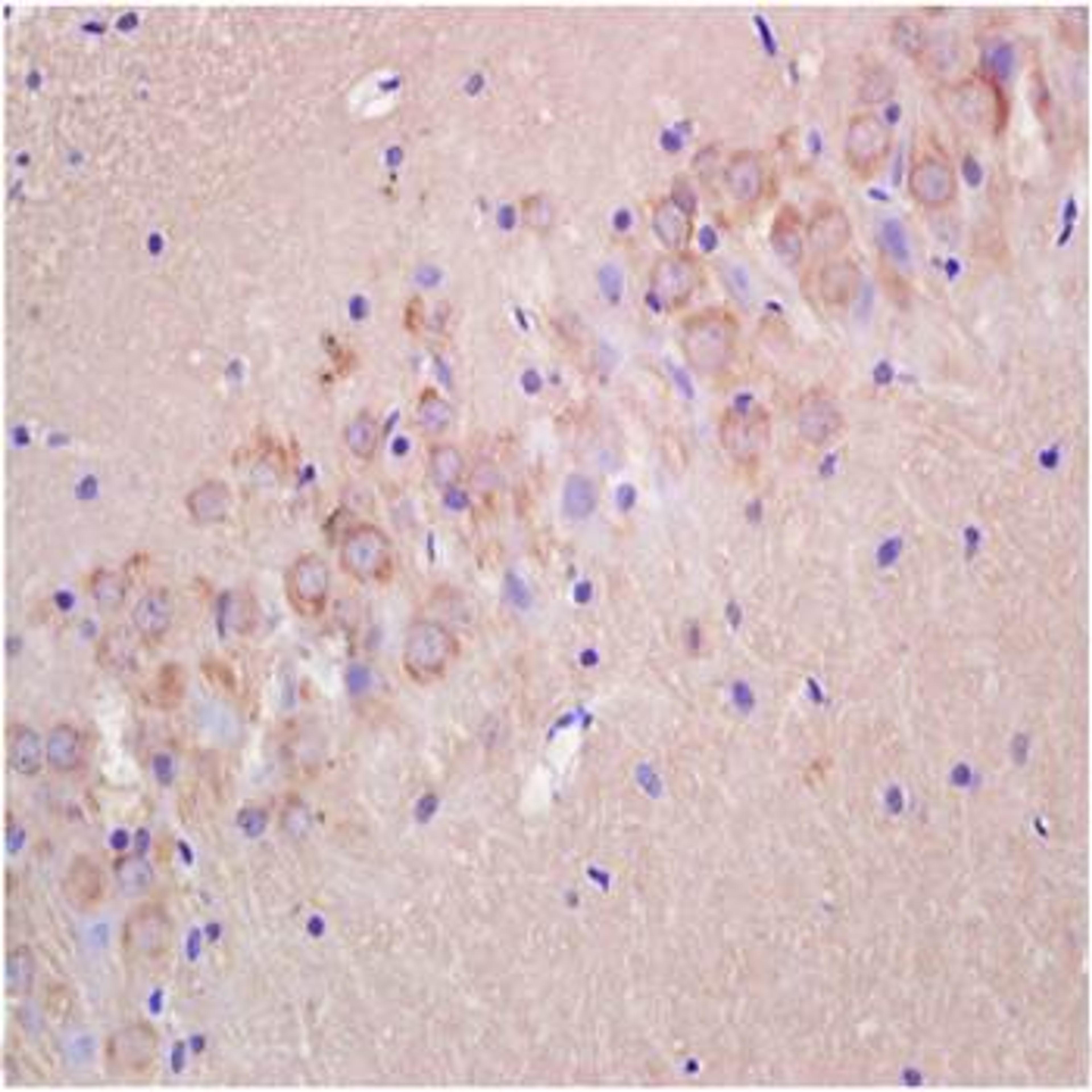 Paraffin-embedded rat brain tissue fixed with 4% paraformaldehyde. Antigen retrieval by boiling with citrate buffer. Blocking buffer is goat serum (37 degrees for 20 min.). P2RX4 antibody at 1:200 dilution with overnight incubation at 4 degrees