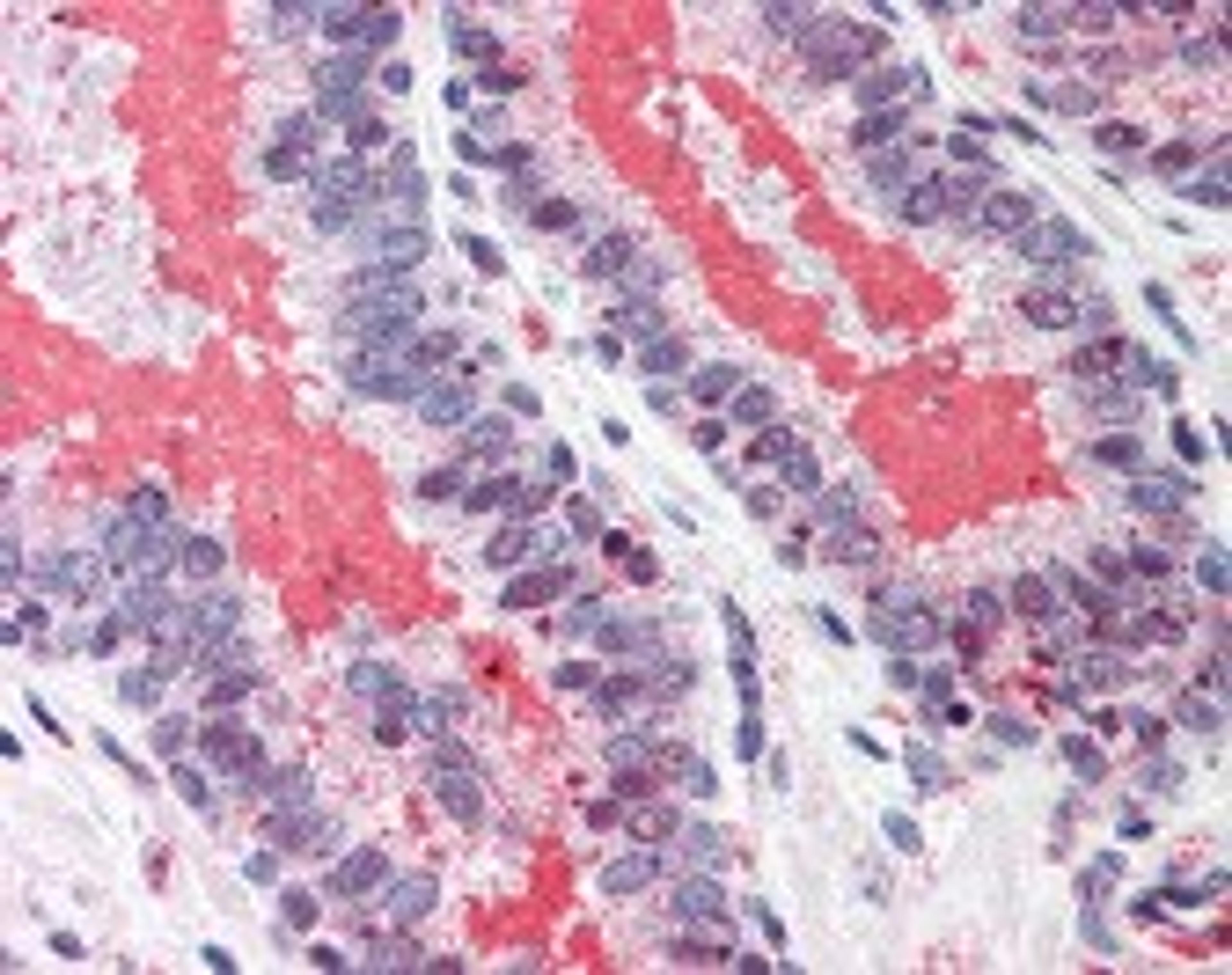 Immunohistochemistry staining of PRKDC in prostate tissue using PRKDC Antibody.