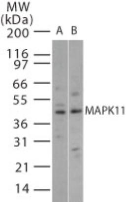 Western Blot: MAPK11 Antibody [NB100-56446] - analysis of MAPK11 in 15 ugs of (A) human brain and (B) mouse brain cell lysate using this antibody.