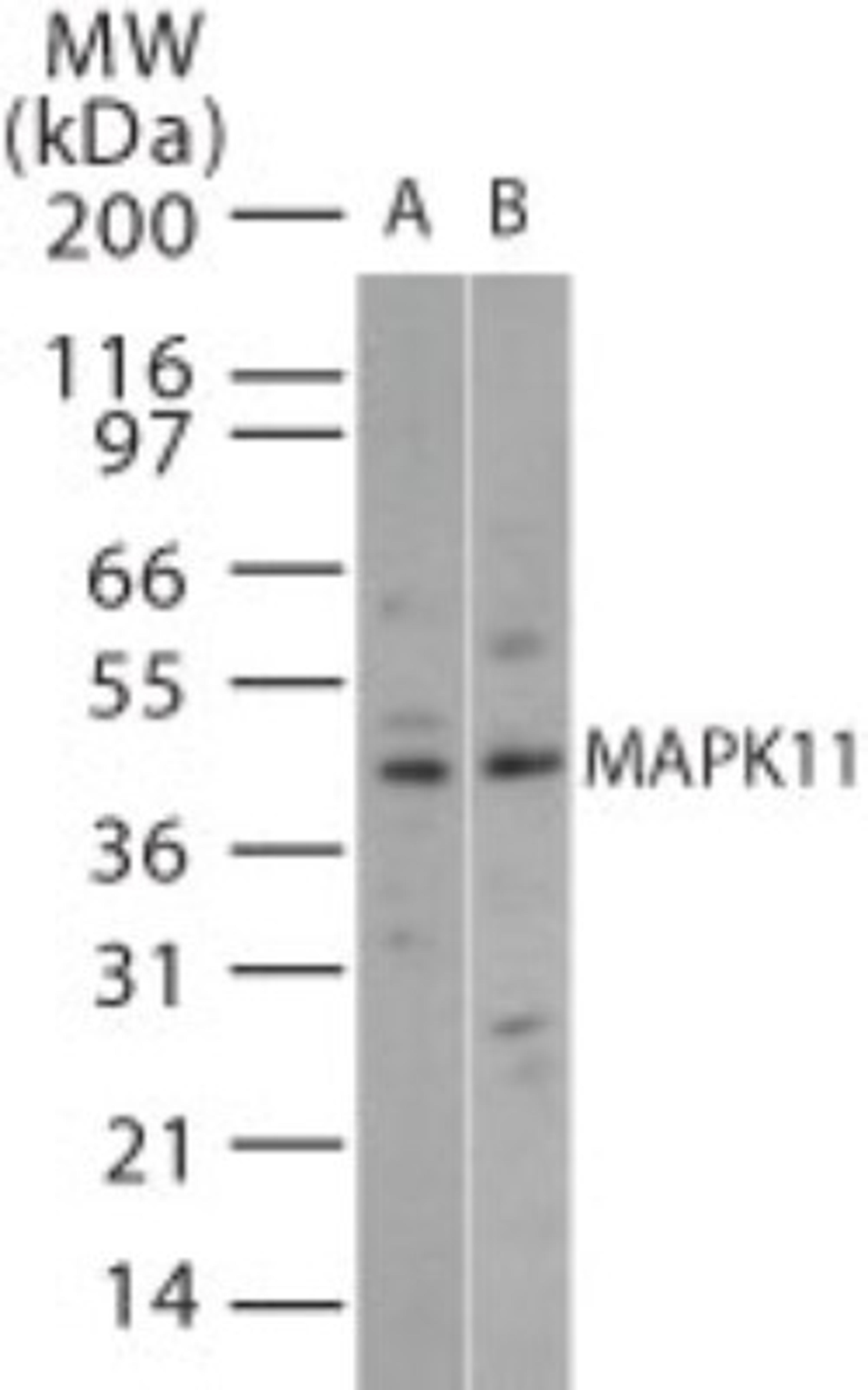 Western Blot: MAPK11 Antibody [NB100-56446] - analysis of MAPK11 in 15 ugs of (A) human brain and (B) mouse brain cell lysate using this antibody.