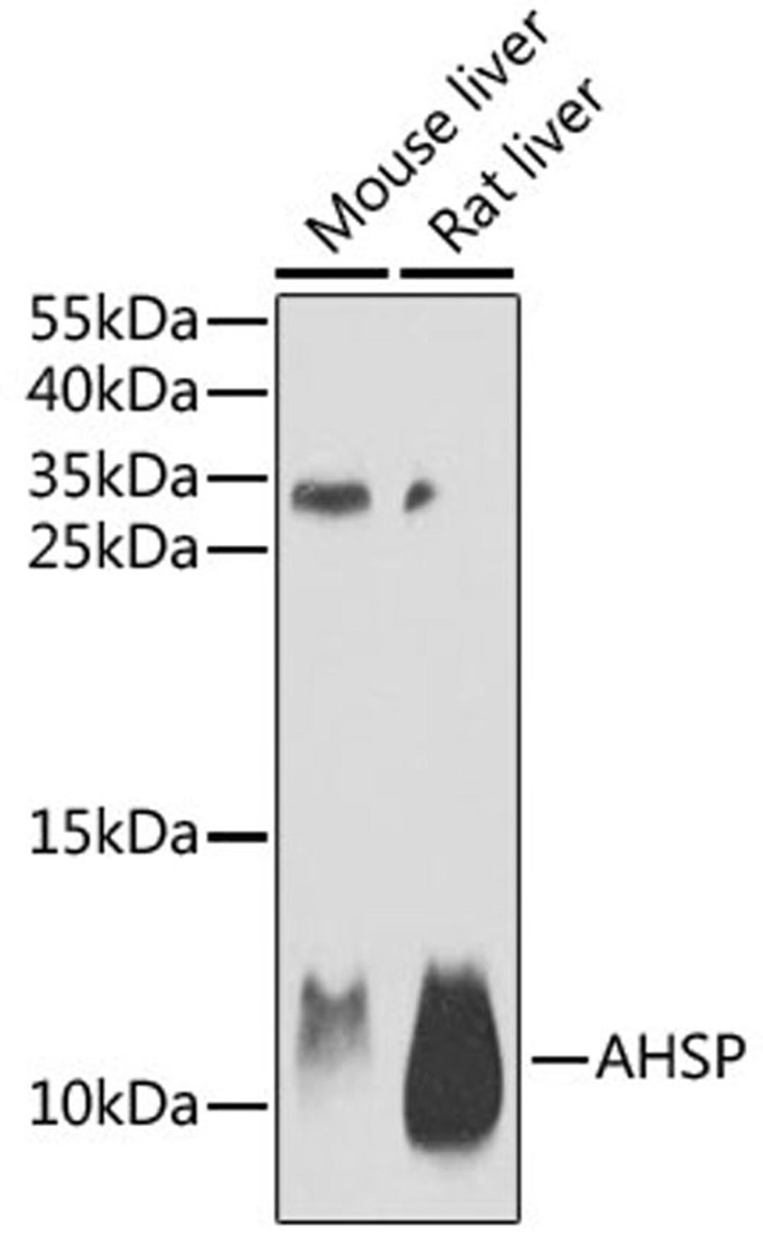 Western blot - AHSP antibody (A6465)