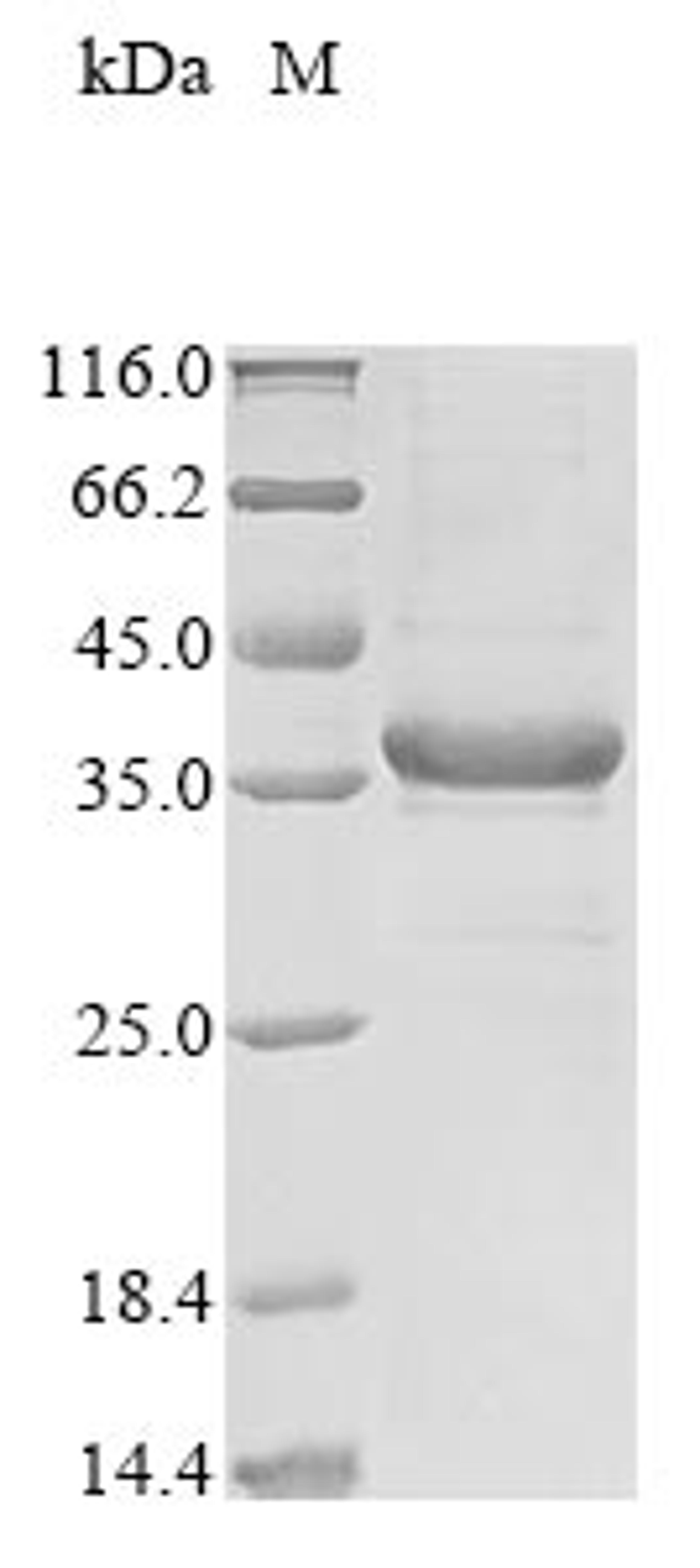 (Tris-Glycine gel) Discontinuous SDS-PAGE (reduced) with 5% enrichment gel and 15% separation gel.