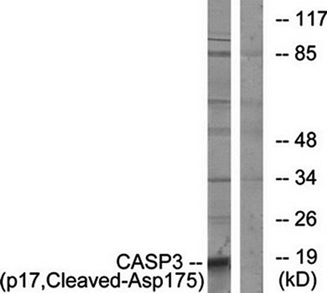 Western blot analysis of extracts from COLO cells using Caspase 3 (p17, Cleaved-Asp175) antibody