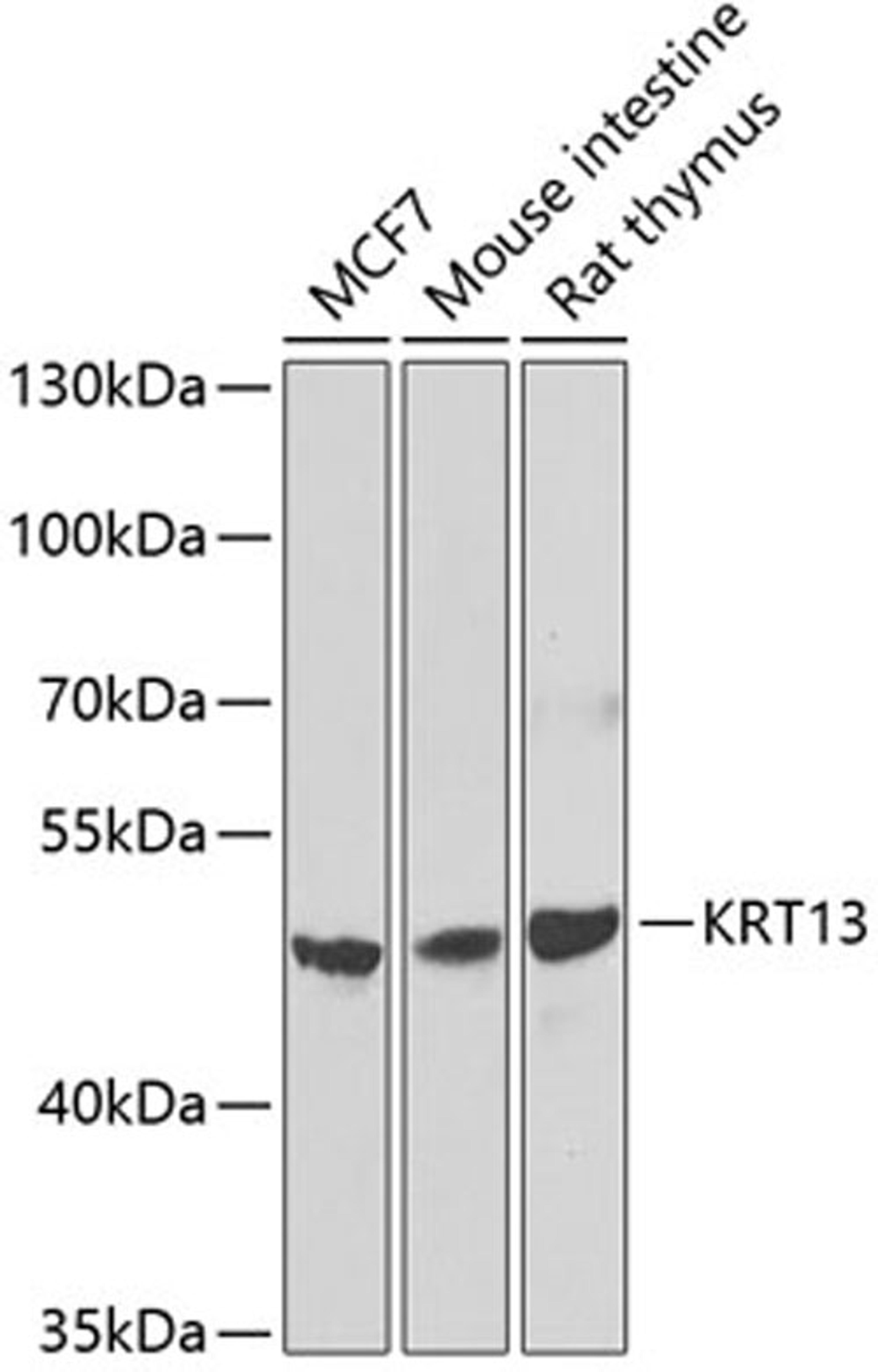 Western blot - KRT13 antibody (A7697)