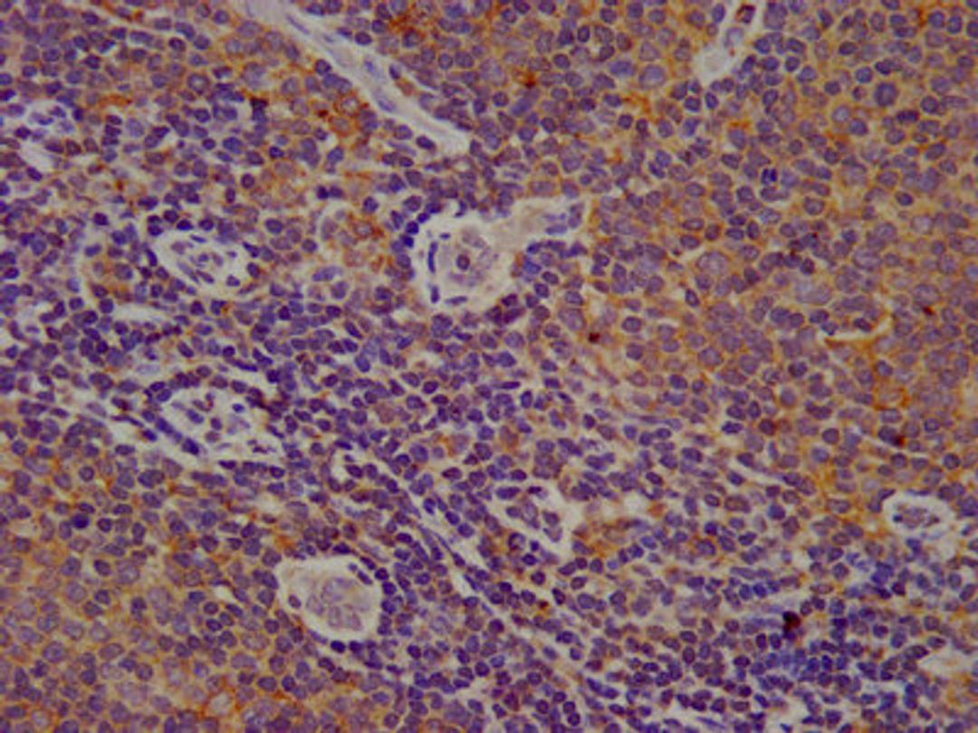 IHC image of CSB-PA006323LA01HU diluted at 1:200 and staining in paraffin-embedded human lymph node tissue performed on a Leica BondTM system. After dewaxing and hydration, antigen retrieval was mediated by high pressure in a citrate buffer (pH 6.0). Section was blocked with 10% normal goat serum 30min at RT. Then primary antibody (1% BSA) was incubated at 4&deg;C overnight. The primary is detected by a biotinylated secondary antibody and visualized using an HRP conjugated SP system.