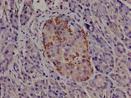 Immunohistochemistry of paraffin-embedded human pancreatic tissue using CSB-PA624029LA01HU at dilution of 1:100